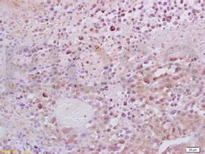 豪门国际官网-追求康健,你我一起开展