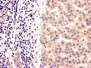 豪门国际官网-追求康健,你我一起开展