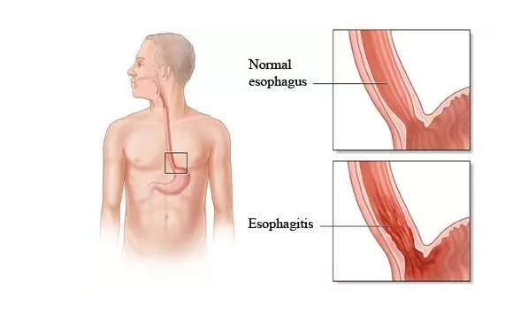 豪门国际官网-追求康健,你我一起开展