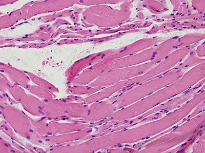 豪门国际官网-追求康健,你我一起开展