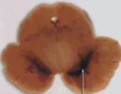 正凡人：：：正：：：谥