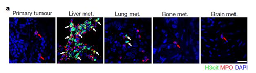 转入小鼠模子获得相同的试验效果，且在转移爆发前NET已在肝脏聚积。