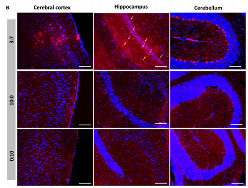 被包裹在含有NT-类脂质的LNP中的Cre重组酶乐成转移！。大脑中的转染神经元呈红色高亮！。