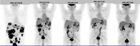 使用PET预测药物的恒久药效