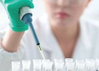 Science子刊：：一种新模子可预测微粒制剂的可注射性