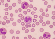 一种神秘颗粒被发明了！！！它能否成为败血症早筛标记物？