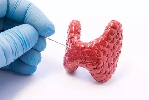 甲状腺疾。。，包括甲状腺功效减退和甲状腺功效亢进，，自古以来就是重复被医学研究职员研究的疾病